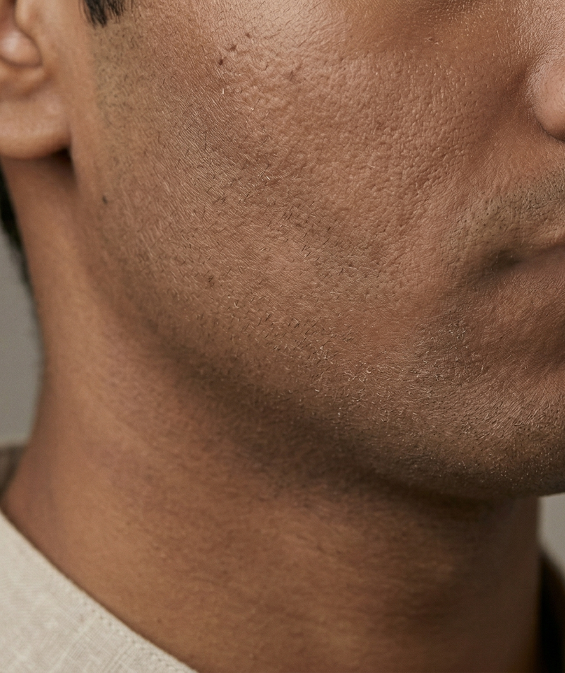 Close-up of a person's neck and jawline with a neutral background